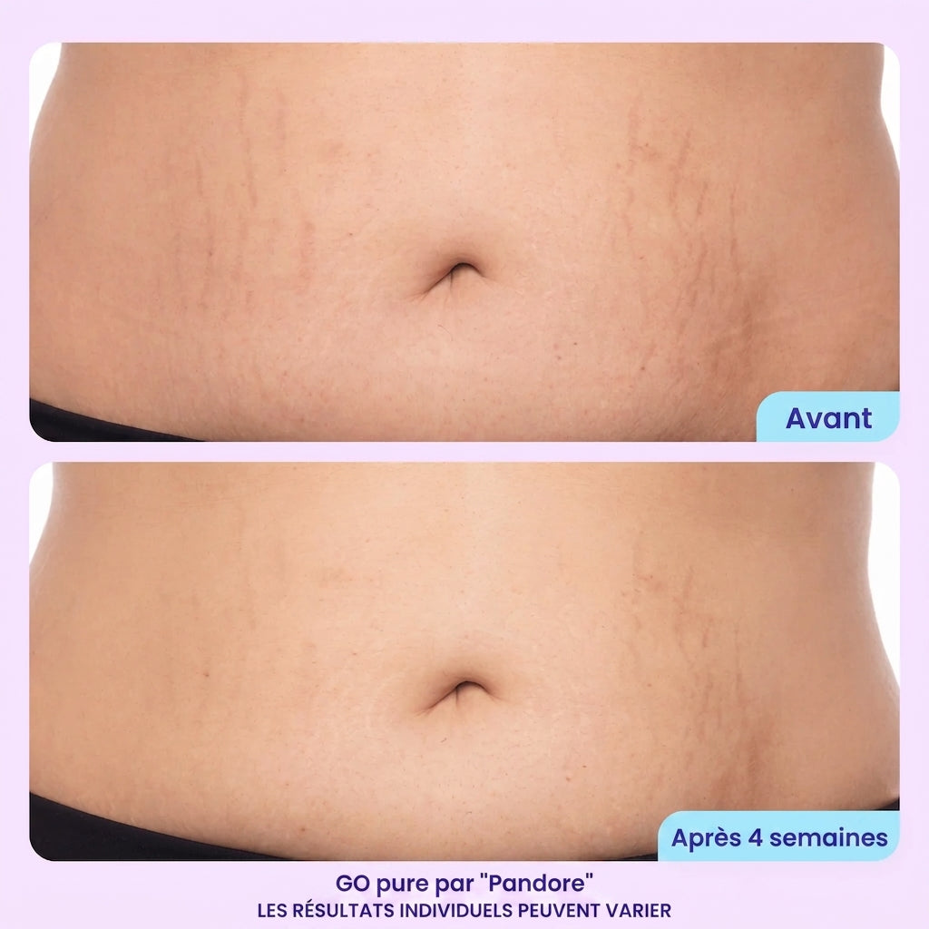 Crème raffermissante et lissante pour le ventre