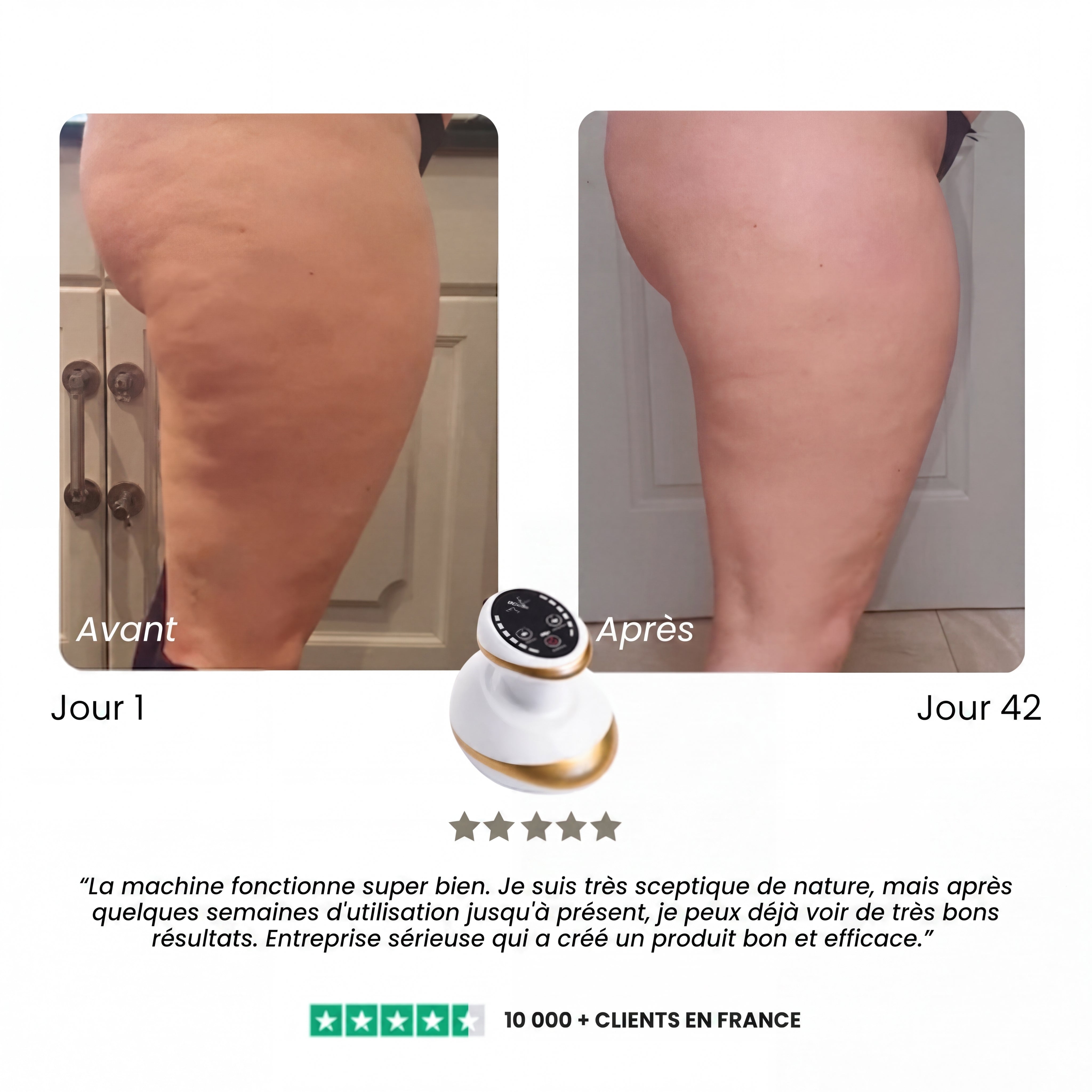 Pandore Sculpt™ | Soin anti-cellulite à domicile