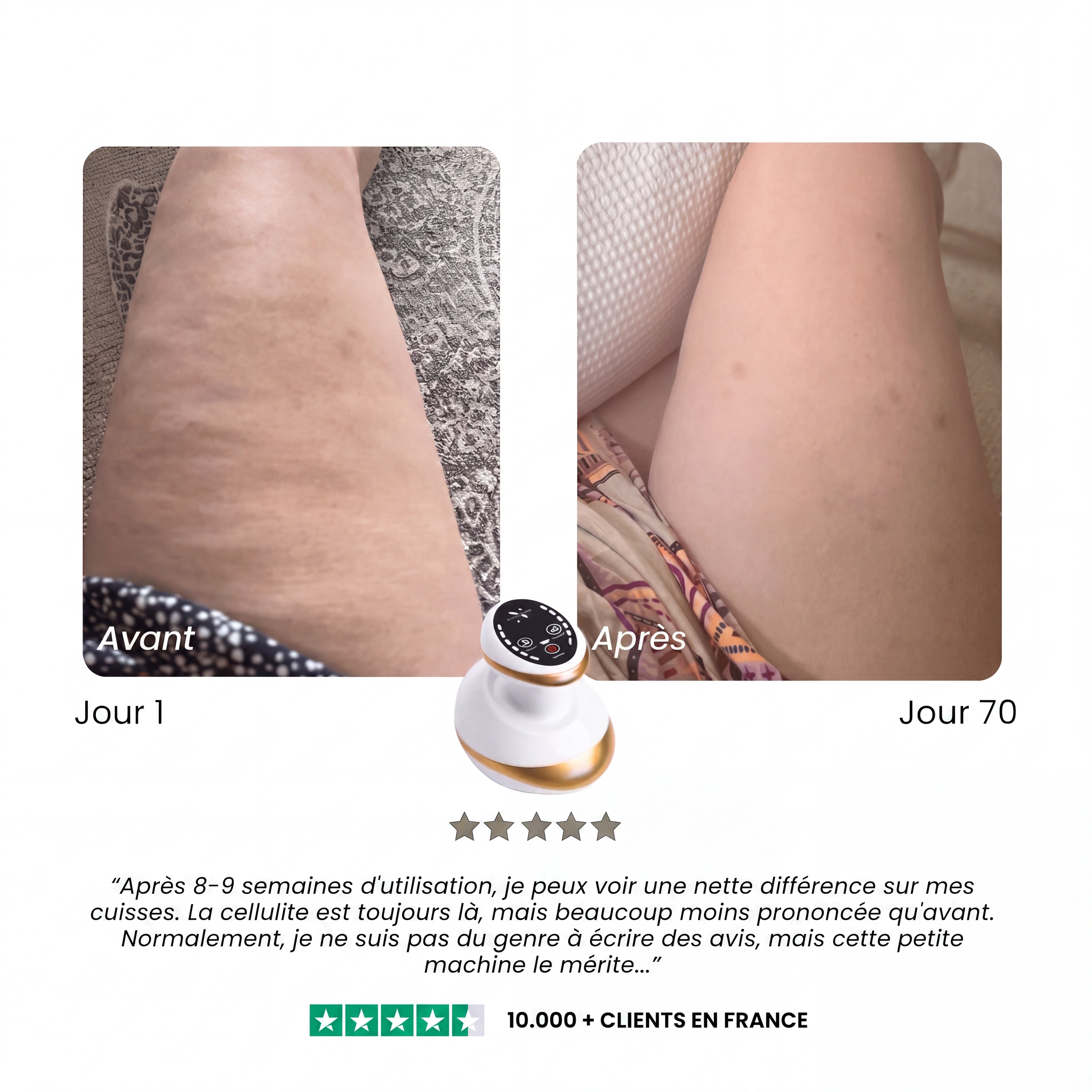 Pandore Sculpt™ | Soin anti-cellulite à domicile